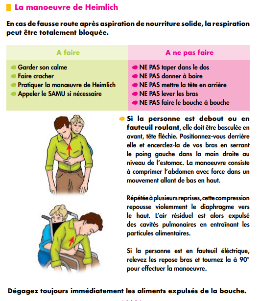 Conseils sur la bonne pratique du geste de Hemlich